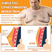 Load image into Gallery viewer, BIANCAT™ ALPHACHEST BEE VENOM FAT LOSS OIL